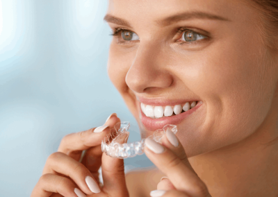 הלבנת שיניים: איך עושים זאת בקלות ובמהירות?